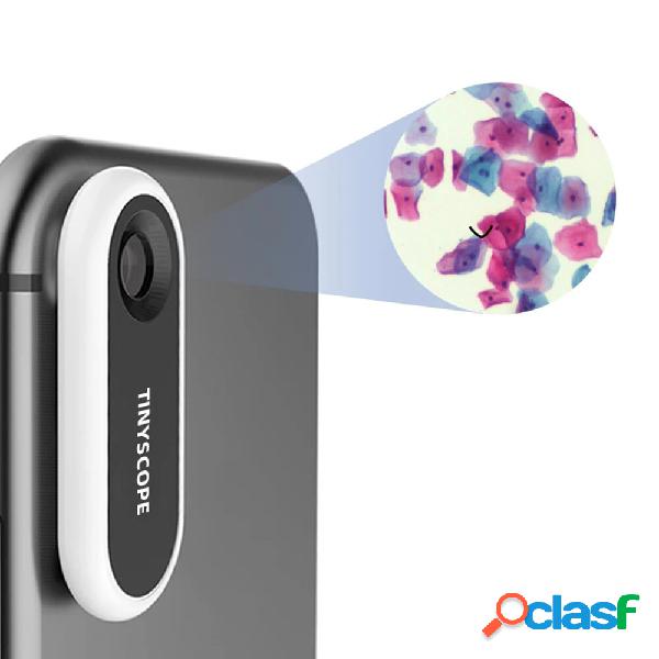 TIPSCOPE TINYSCOPE TS-V1 Microscopio tascabile mobile lente