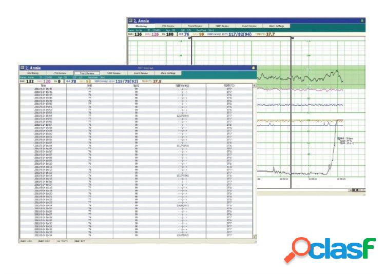 Software per monitor fetali